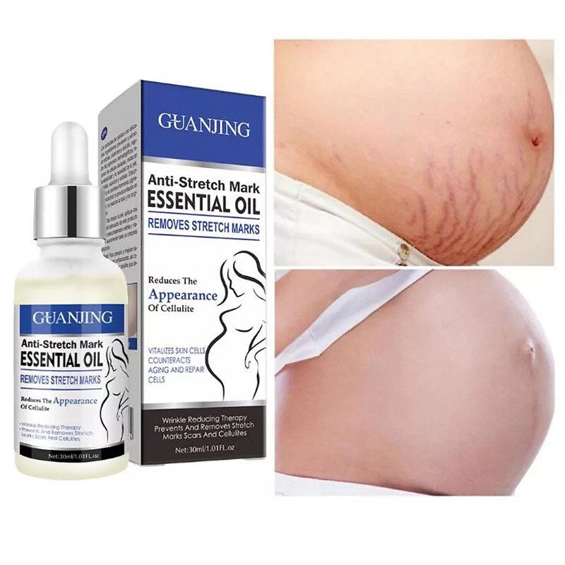 Anti Stretch Marks Essential Oil