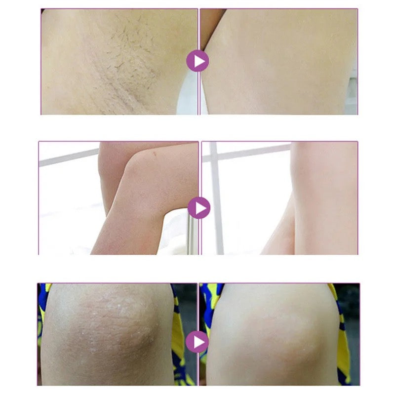 Sensitive Parts Whitening Cream
