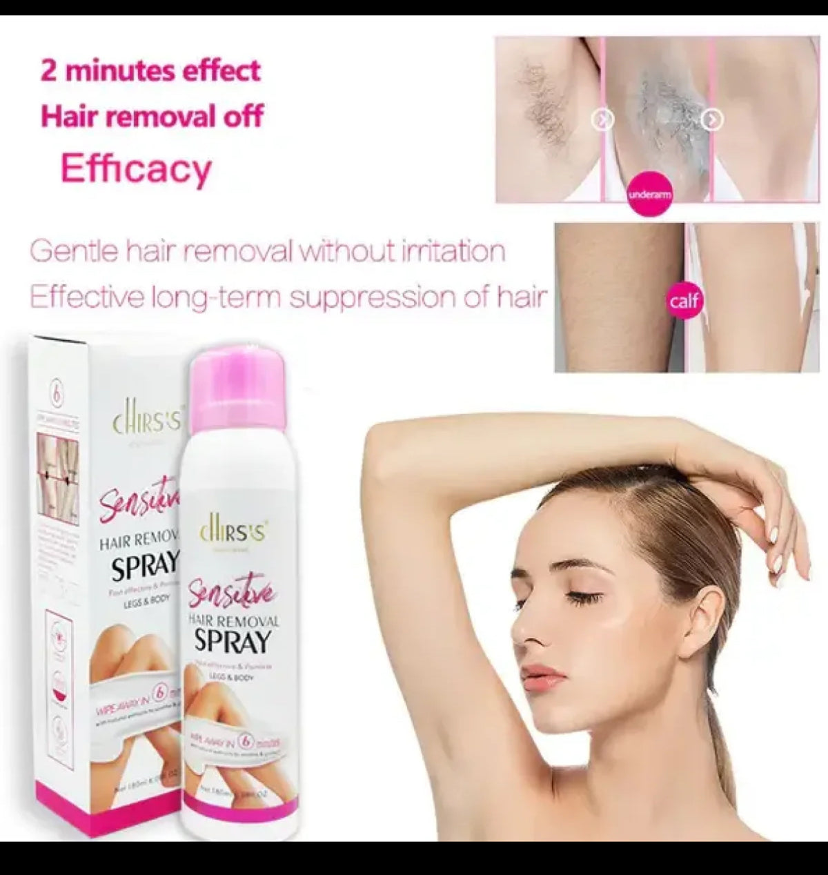 CHIRSIS HAIR REMOVER SPRAY 180ML